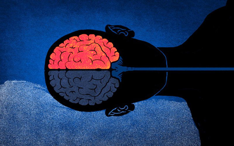 Độ sâu giấc ngủ giữa não trái và não phải đã có sự bất đối xứng