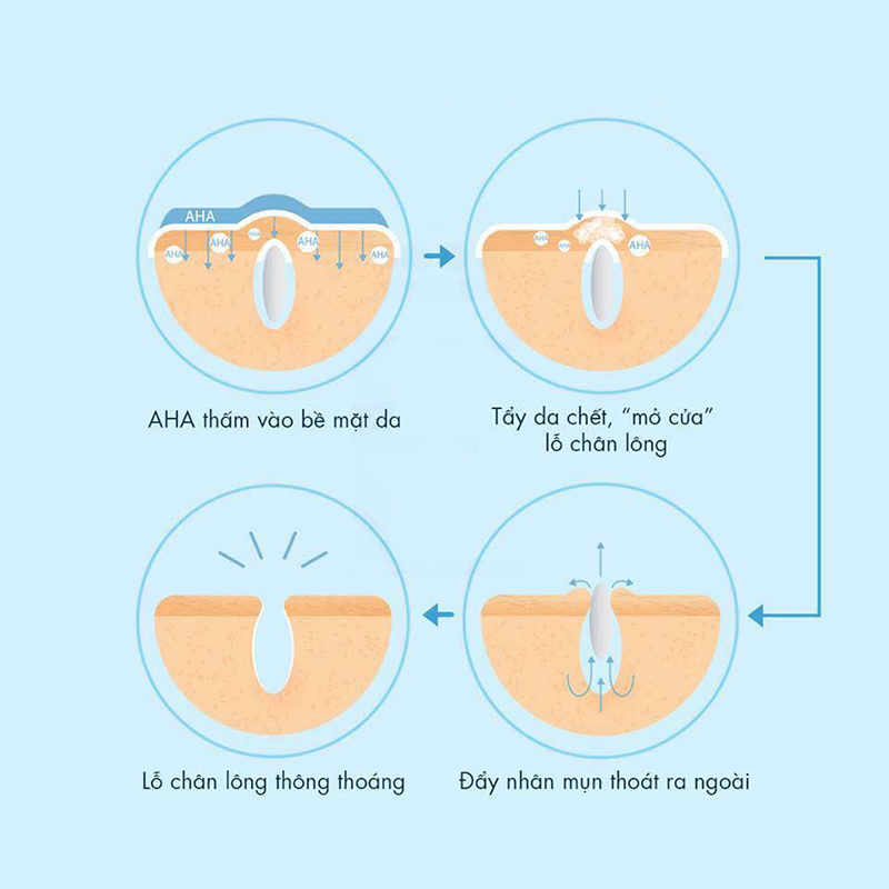 AHA có thể dễ dàng tan trong nước nên có tác dụng trên bề mặt da