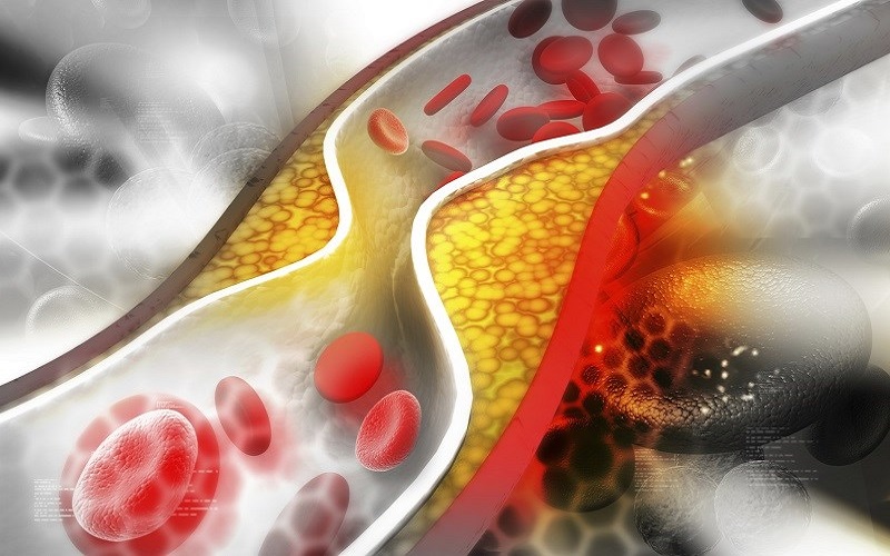 Công dụng của giấm Balsamic có thể giảm lượng Cholesterol trong máu