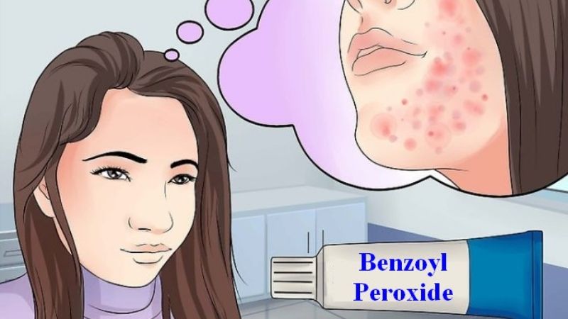 Khác biệt giữa tác dụng phụ và dị ứng benzoyl peroxide
