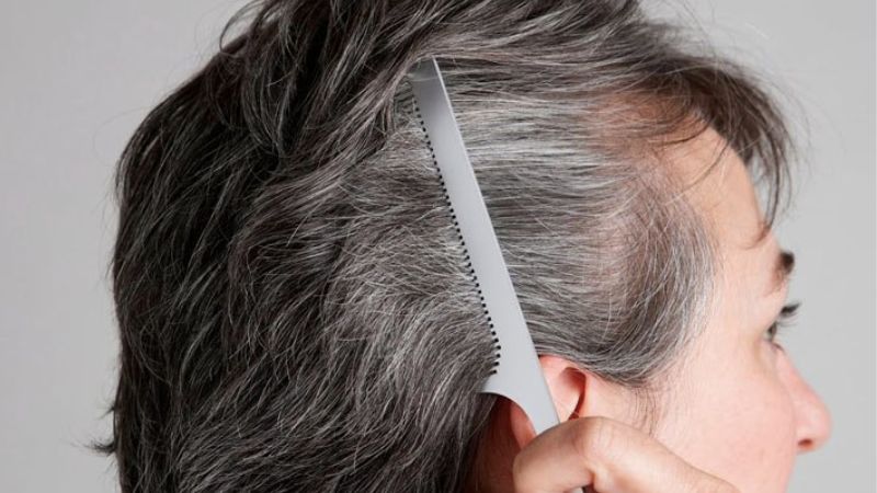 Hà thủ ô đỏ giúp cải thiện tóc bạc sớm, giảm rụng tóc