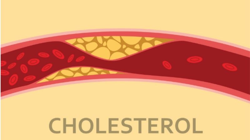 Cây cà ri giảm cholesterol xấu