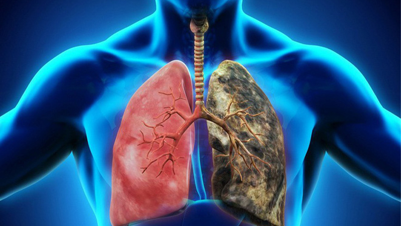 Nấm lim xanh có thể điều trị ung thư phổi