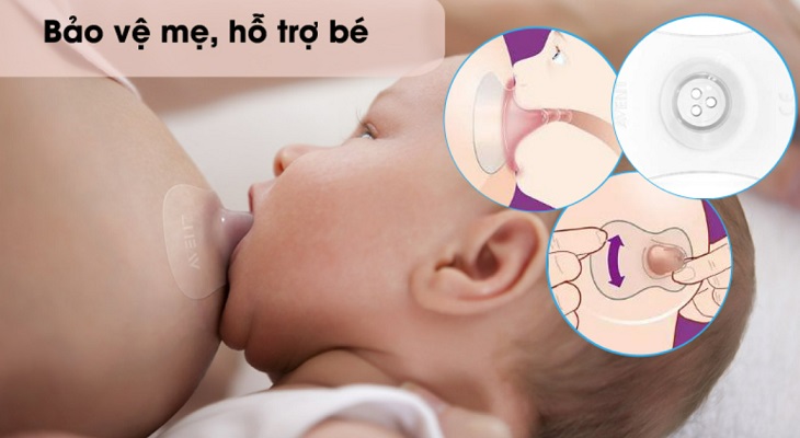 Dùng núm trợ ti phù hợp cho bé gặp khó khăn khi ngậm ti sữa và giúp mẹ giảm bớt cơn đau đầu ti 