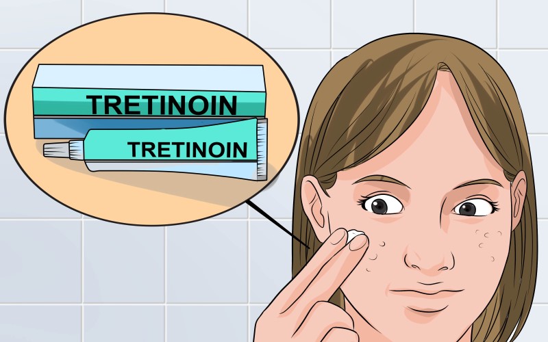 Tretinoin có tác dụng gì?