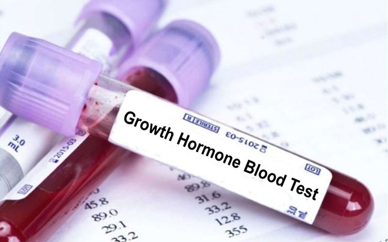 Xét nghiệm hormone tăng trưởng là gì?