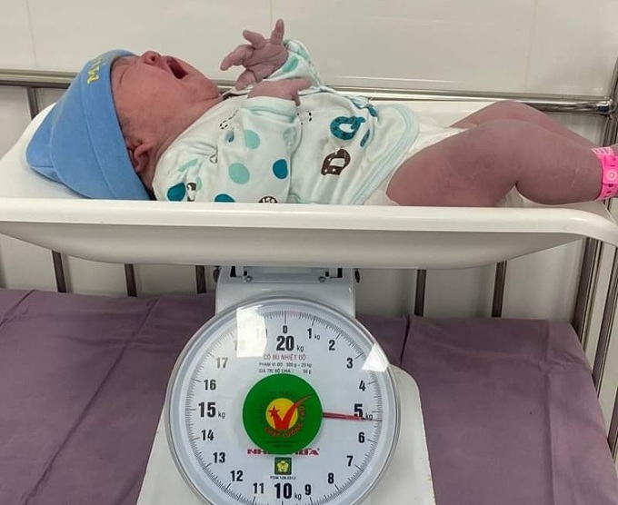 Bé gái chào đời nặng 5,4 kg. Ảnh: Bệnh viện cung cấp