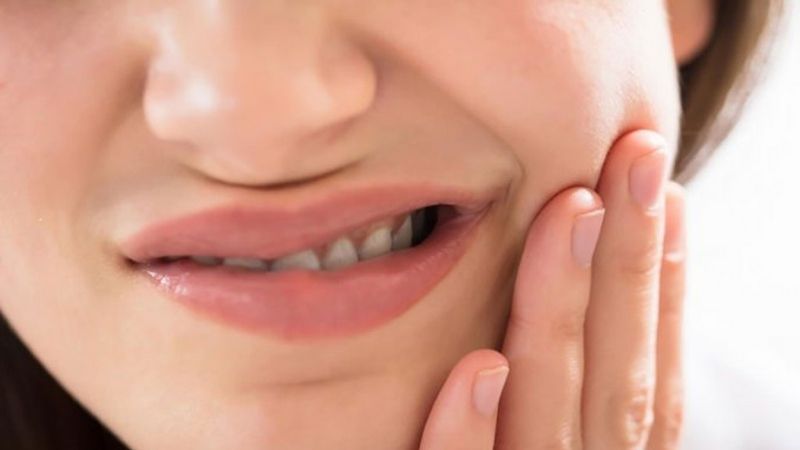 Tập mewing sai cách có thể gây đau hàm