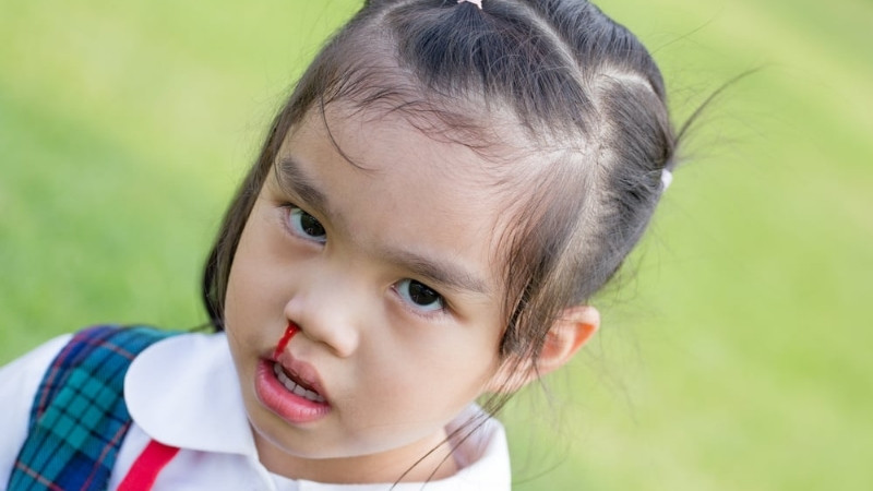 Những nguyên nhân gây chảy máu mũi ở trẻ là gì?