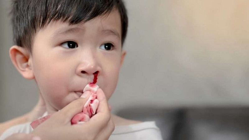 Cách phòng và điều trị chảy máu mũi ở trẻ em