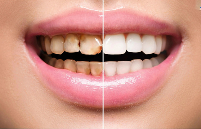 Việc chăm sóc răng miệng đúng cách ảnh hưởng lớn tới sức khỏe mọi người. Ảnh minh họa: aboluowang