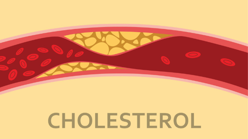 Mỡ cá giúp hạ cholesterol (có hại) trong máu