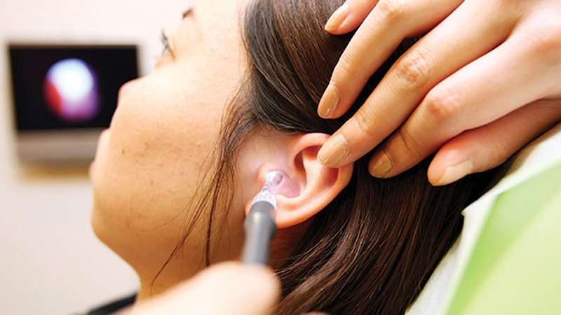 Lấy ráy tai bằng phương pháp rửa tai